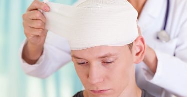 concussion rates in children